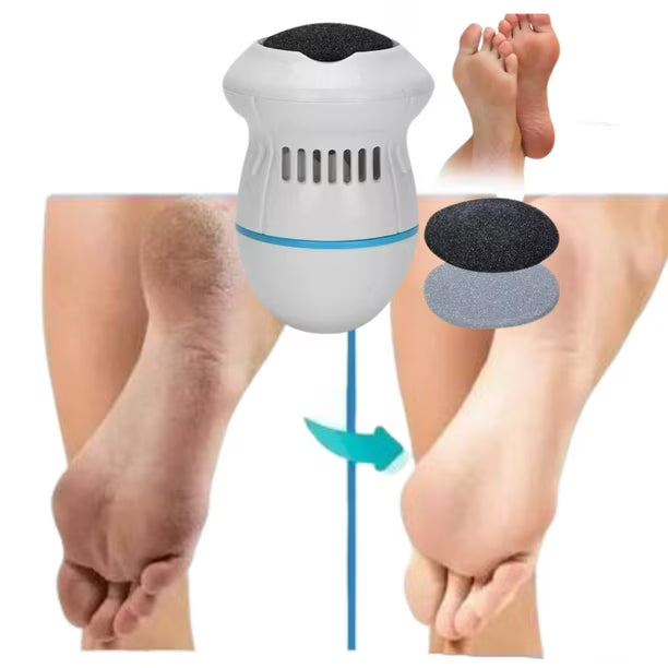 SilkyFeet™ Eliminador de Callos y Durezas